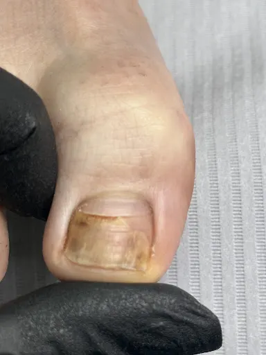 Podolog Gabinet Podologiczny Zdrowa Stopa